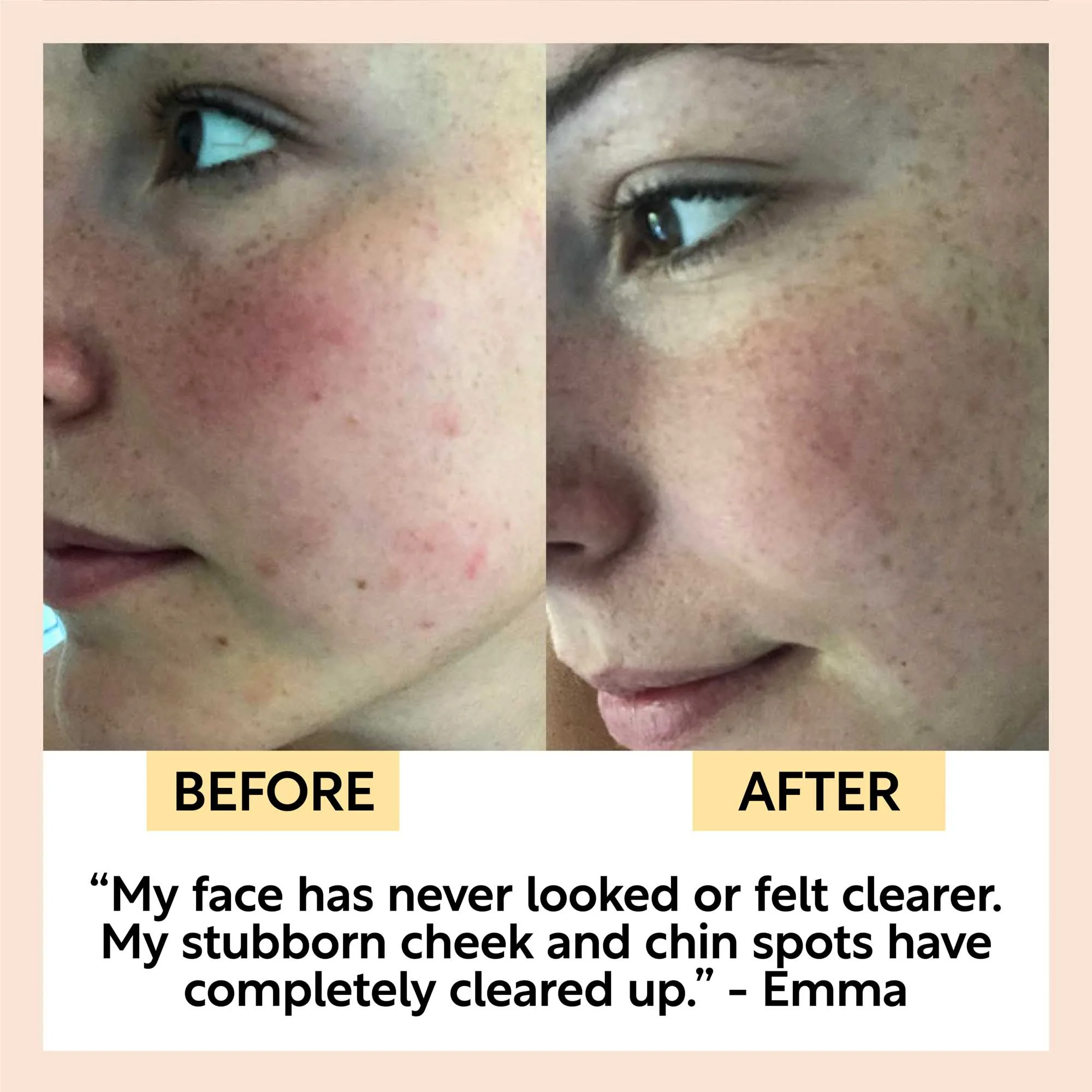 Fennel + Cardamom Chai Cleansing Bar - Image 8