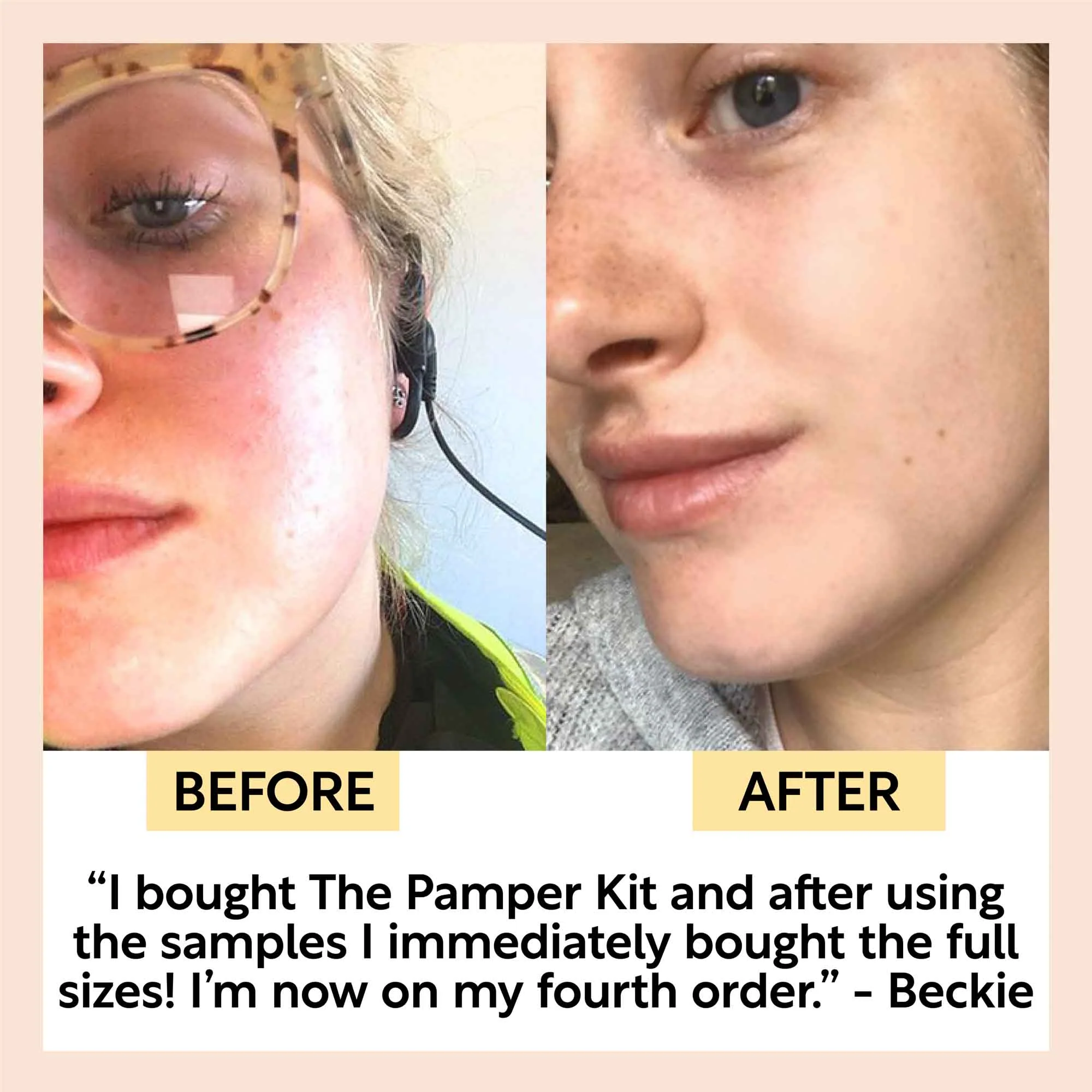 "Pamper + Gift" Skincare Kit - Image 7