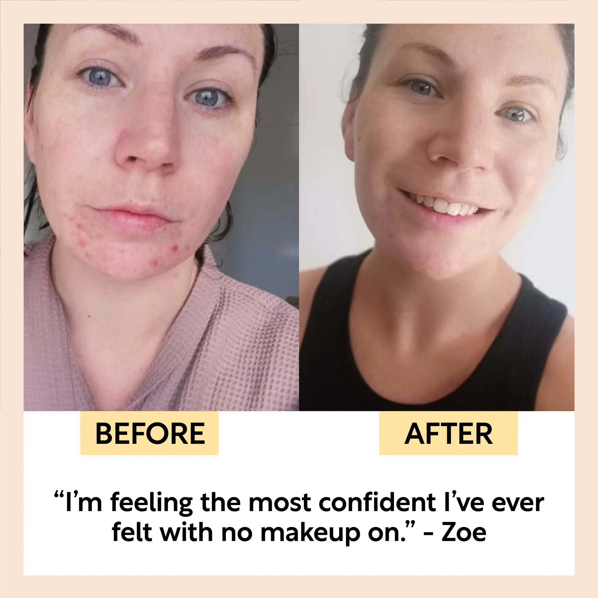 Travel-Size Skincare Bundle - Image 9