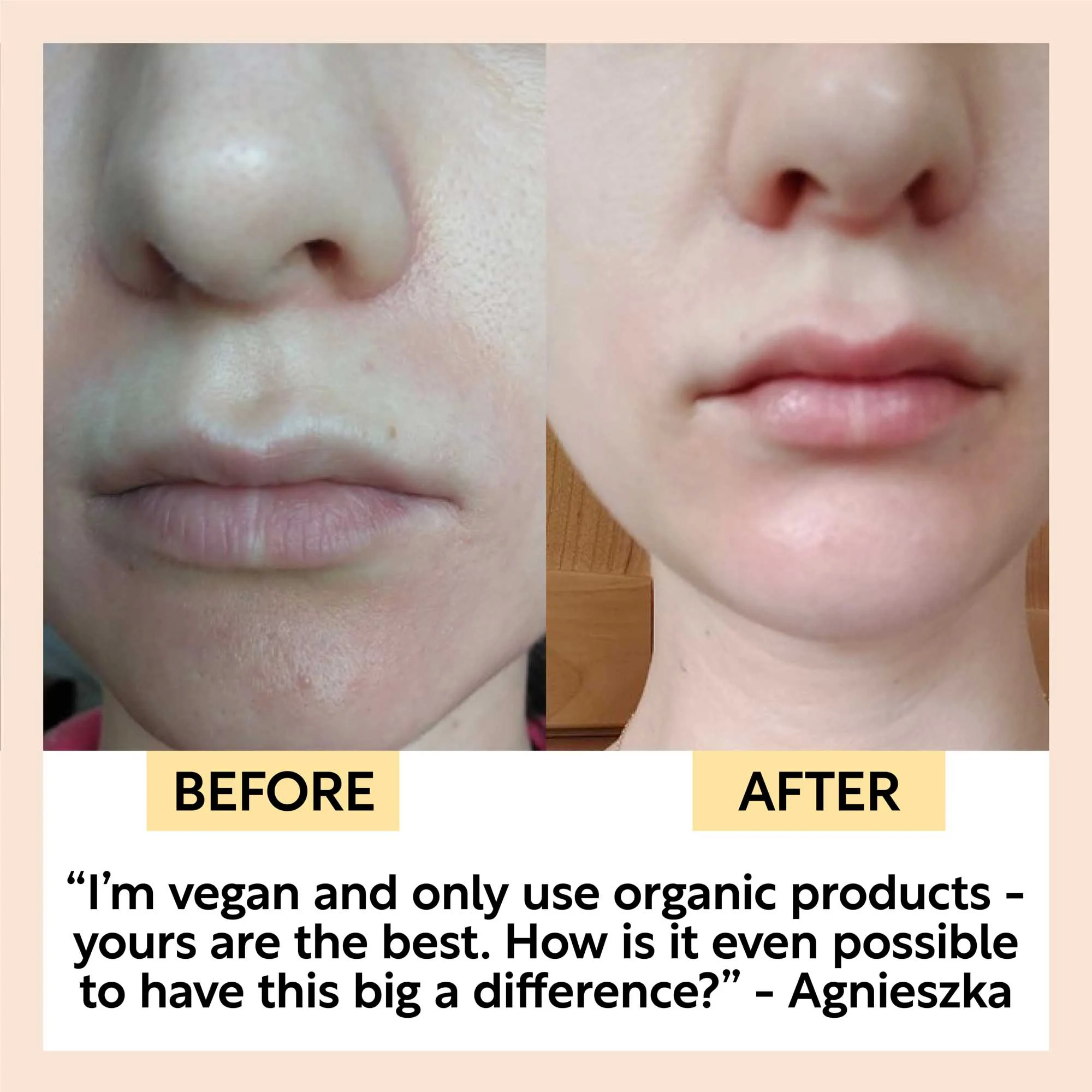 Hydration Skincare Set - Image 7