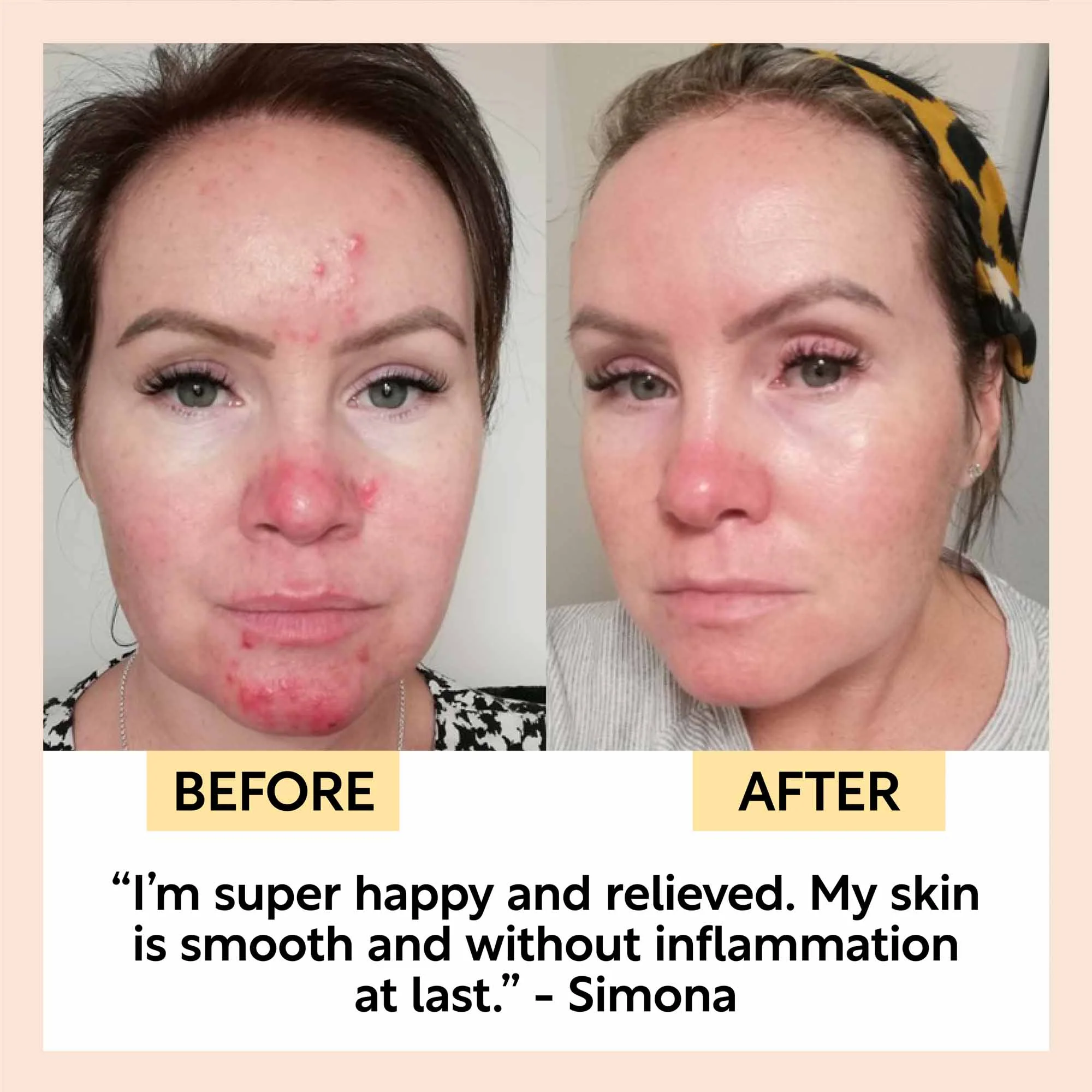 Night Cream with Hyaluronic Acid + Niacinamide - Travel Size - Image 7