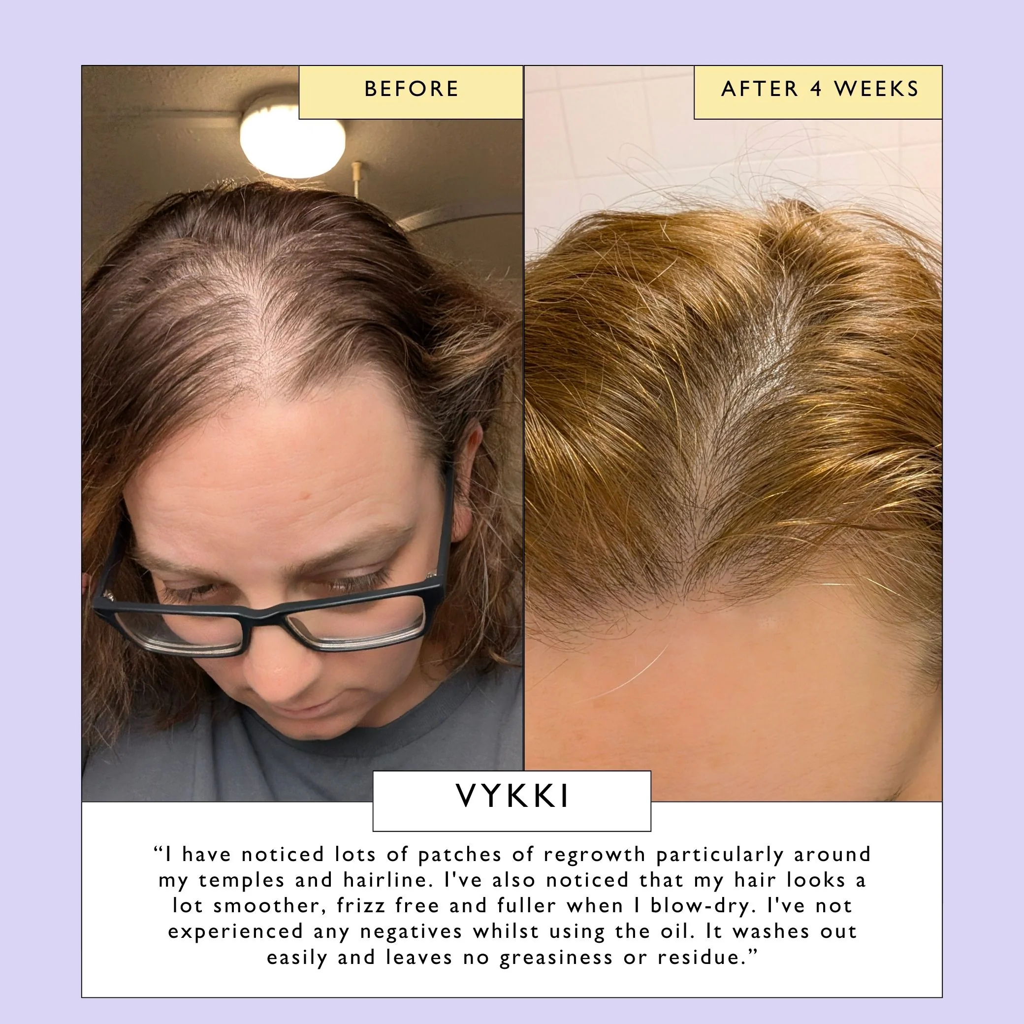 Scalp + Hair Oil with Bacuri Butter + Castor Oil - Image 9